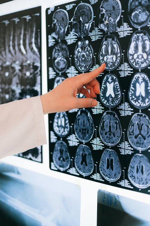brain scan x-rays